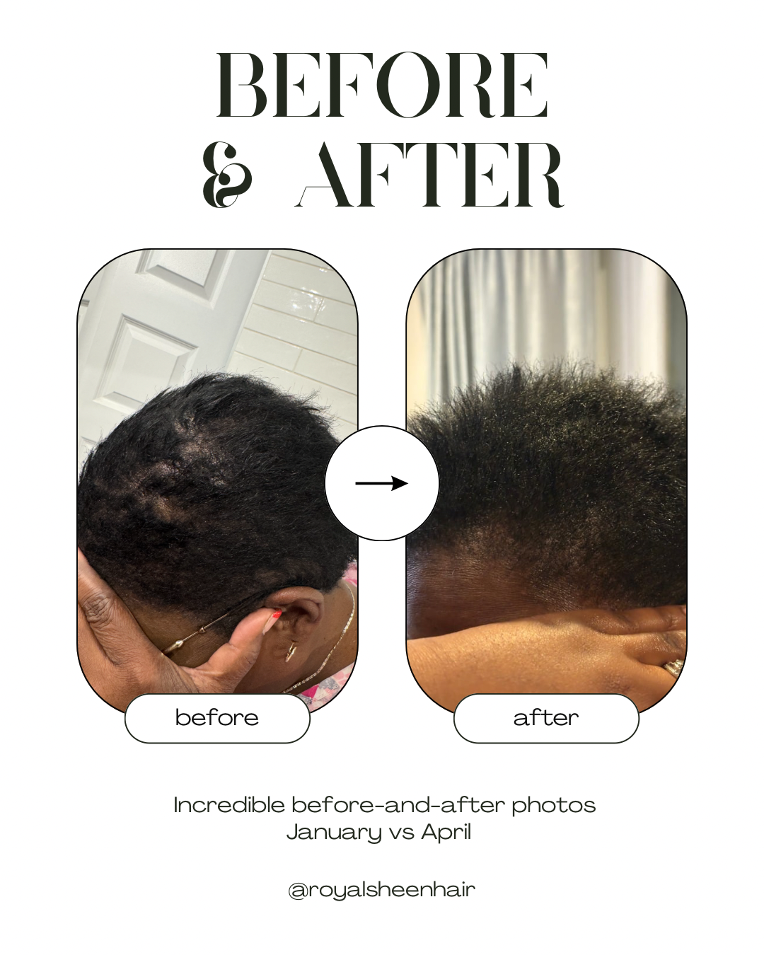Royal Growth Oil - Ayurvedic Hair Elixir